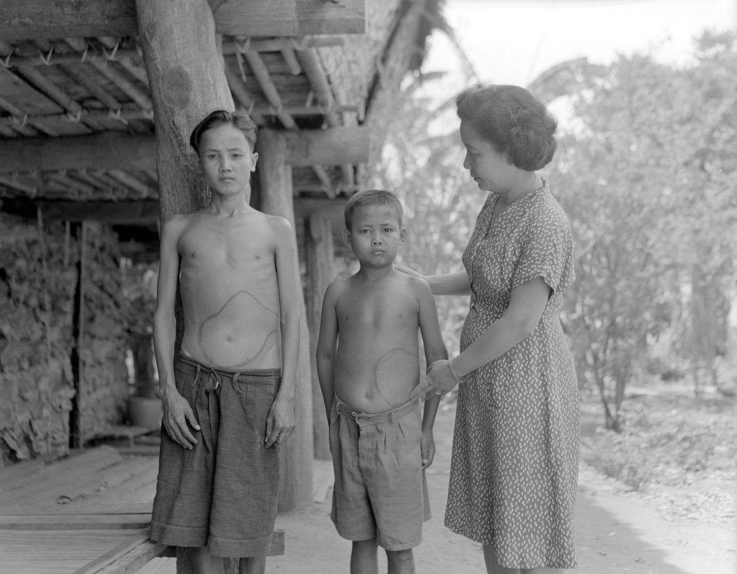 Two Thai children face the camera as a FAO expert checks their height