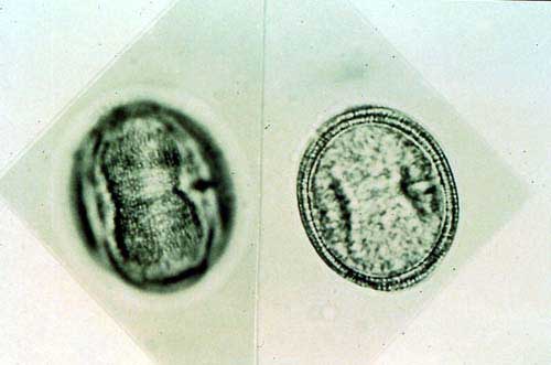 Anarcadium sp. From honey in Guyana