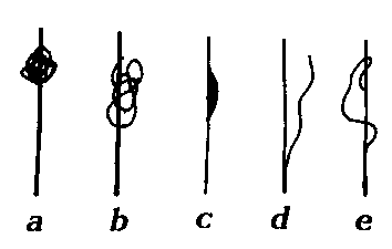 Various cleanness a)Waste, b) Slug, c) Bad casting, d) Split ends, e) Large loop