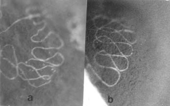 Cocoon spinning curvature